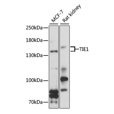 Western Blot - Anti-TIE1 Antibody (A9186) - Antibodies.com