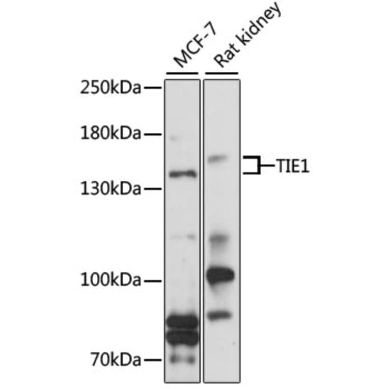Western Blot - Anti-TIE1 Antibody (A9186) - Antibodies.com
