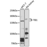 Western Blot - Anti-TIE1 Antibody (A9186) - Antibodies.com