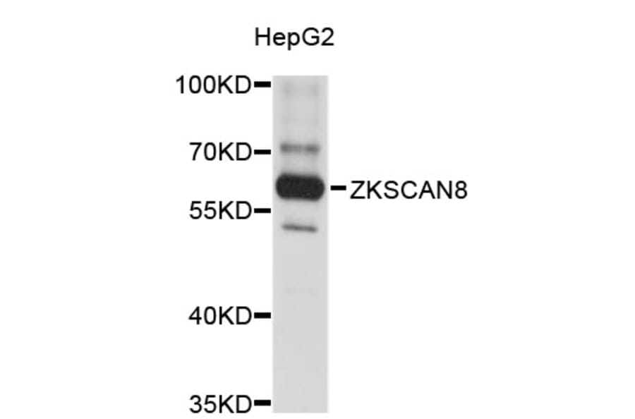 Western Blot - Anti-ZKSCAN8 Antibody (A3341) - Antibodies.com