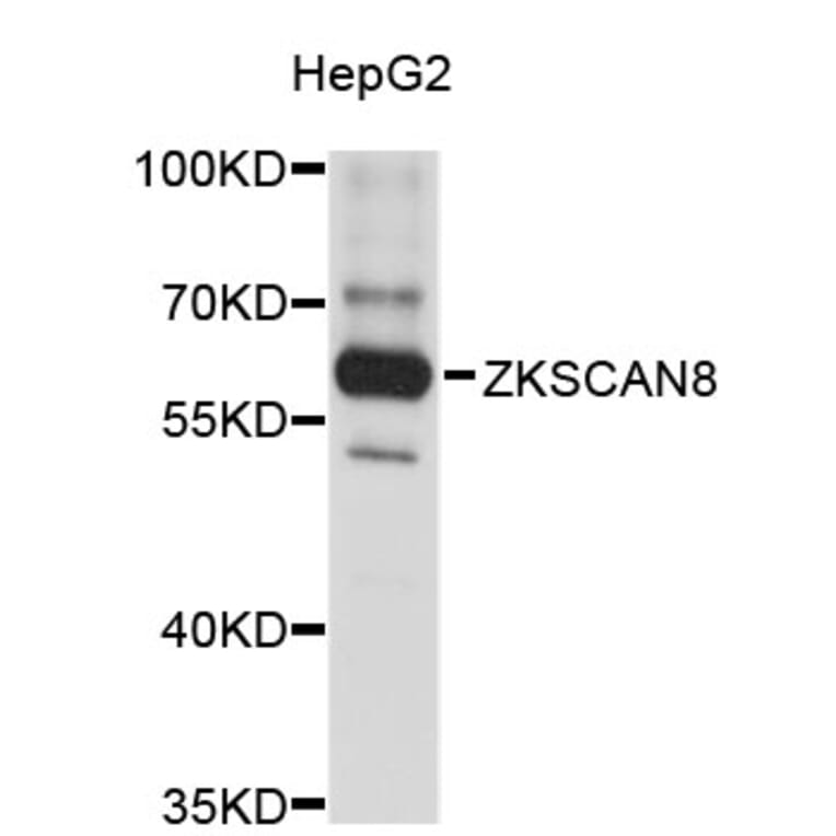 Western Blot - Anti-ZKSCAN8 Antibody (A3341) - Antibodies.com