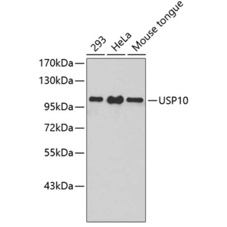 Western Blot - Anti-USP10 Antibody (A3349) - Antibodies.com
