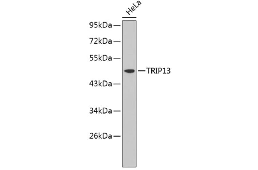 Western Blot - Anti-TRIP13 Antibody (A3352) - Antibodies.com