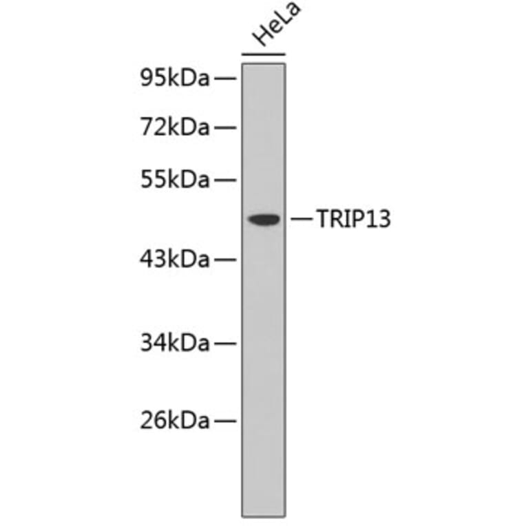 Western Blot - Anti-TRIP13 Antibody (A3352) - Antibodies.com