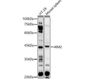 Western Blot - Anti-AIM2 Antibody (A9191) - Antibodies.com