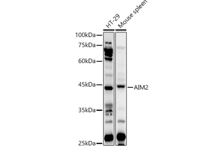 Western Blot - Anti-AIM2 Antibody (A9191) - Antibodies.com