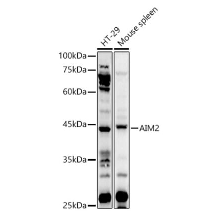 Western Blot - Anti-AIM2 Antibody (A9191) - Antibodies.com