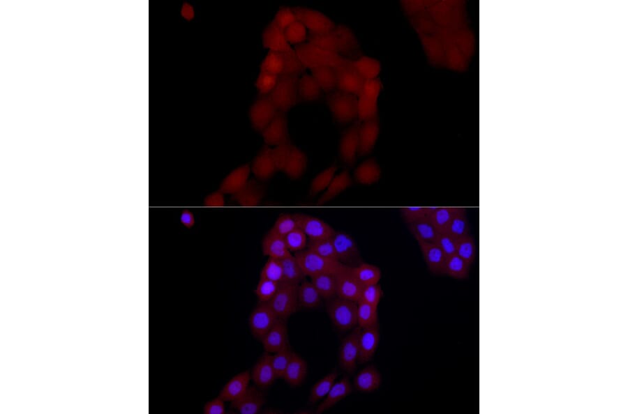 Immunofluorescence - Anti-AIM2 Antibody (A9191) - Antibodies.com
