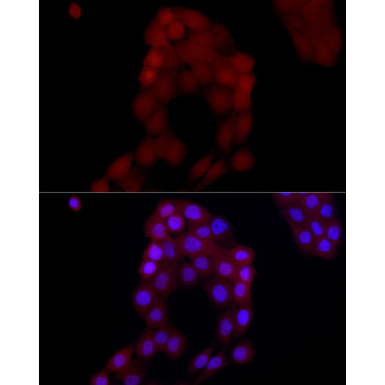 Immunofluorescence - Anti-AIM2 Antibody (A9191) - Antibodies.com