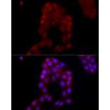 Immunofluorescence - Anti-AIM2 Antibody (A9191) - Antibodies.com