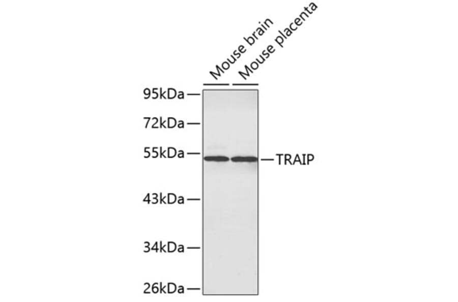 Western Blot - Anti-TRAIP Antibody (A3368) - Antibodies.com