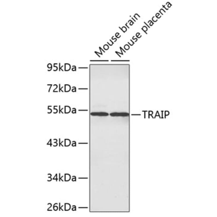 Western Blot - Anti-TRAIP Antibody (A3368) - Antibodies.com