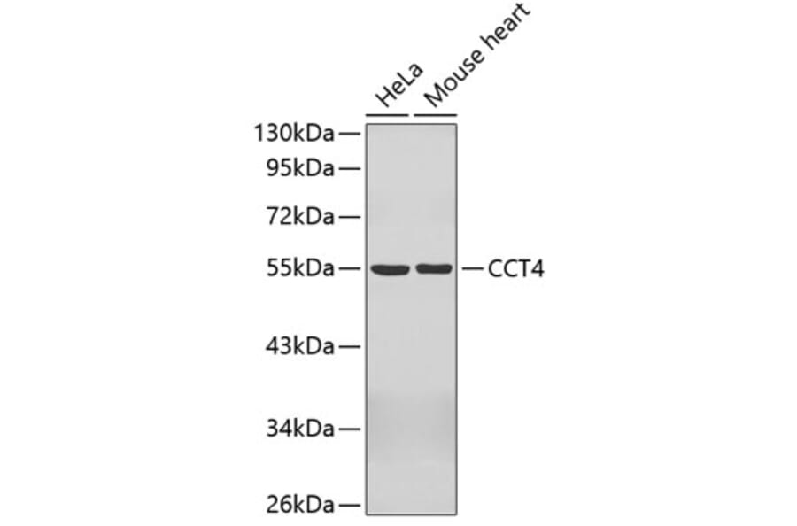 Western Blot - Anti-CCT4 Antibody (A3372) - Antibodies.com