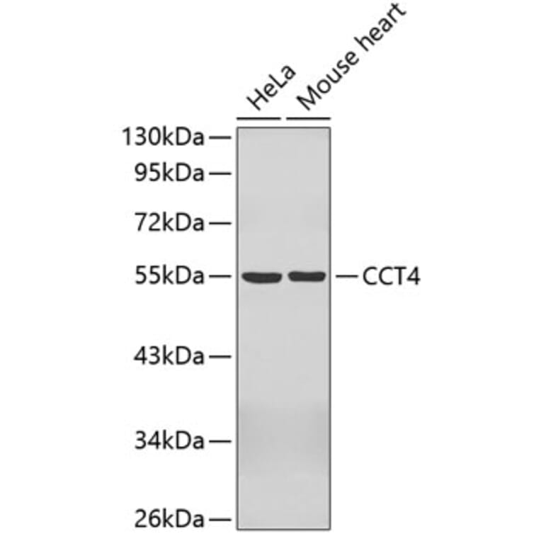 Western Blot - Anti-CCT4 Antibody (A3372) - Antibodies.com