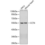 Western Blot - Anti-CCT4 Antibody (A3372) - Antibodies.com