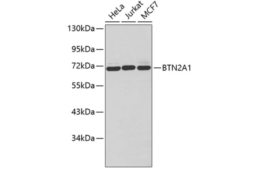 Western Blot - Anti-BTN2A1 Antibody (A3377) - Antibodies.com