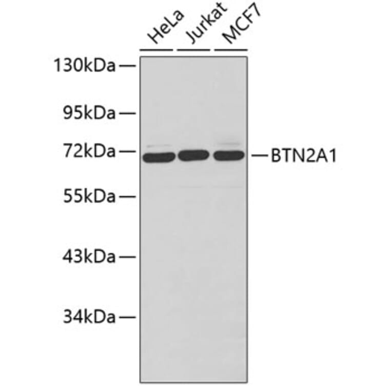 Western Blot - Anti-BTN2A1 Antibody (A3377) - Antibodies.com