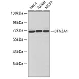 Western Blot - Anti-BTN2A1 Antibody (A3377) - Antibodies.com