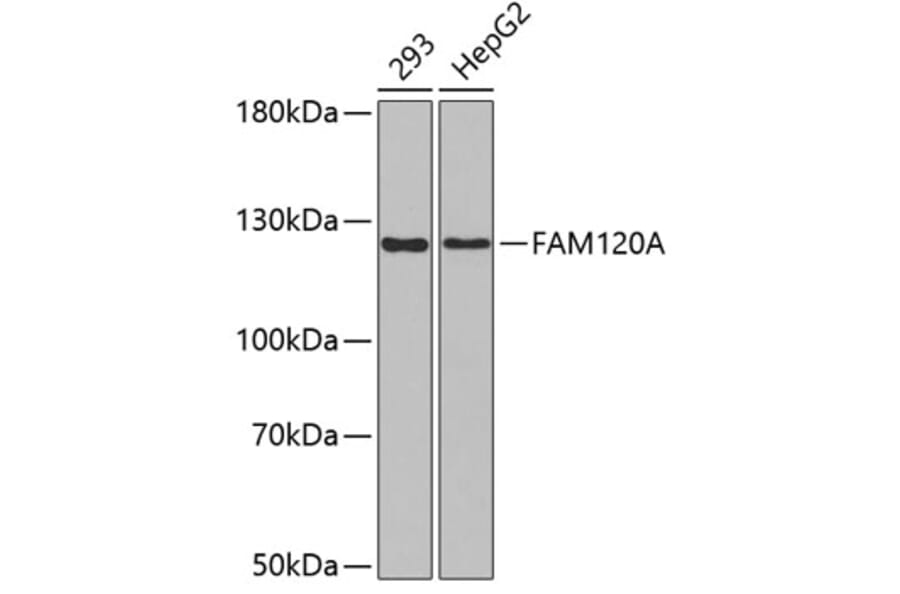 Western Blot - Anti-FAM120A Antibody (A3389) - Antibodies.com