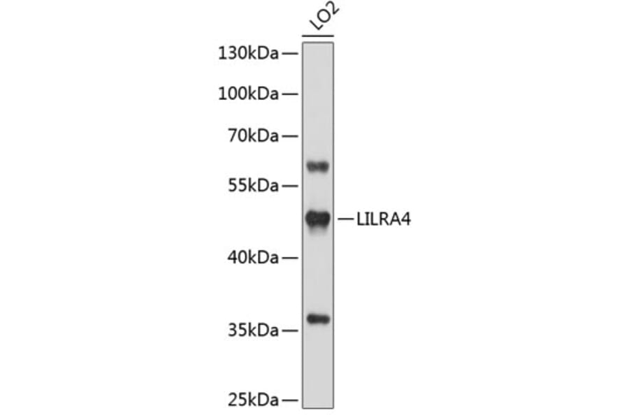 Western Blot - Anti-LILRA4 Antibody (A3396) - Antibodies.com