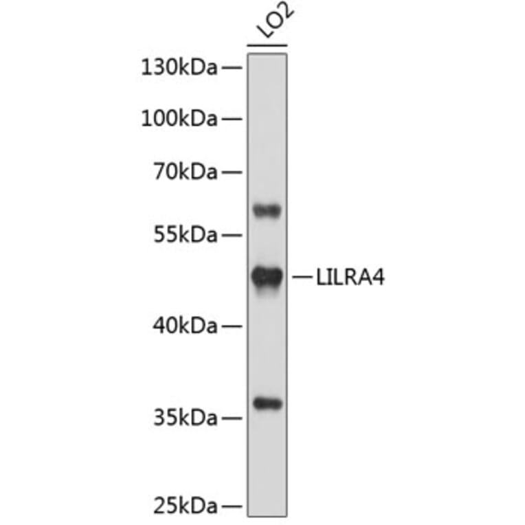 Western Blot - Anti-LILRA4 Antibody (A3396) - Antibodies.com