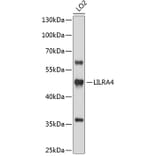 Western Blot - Anti-LILRA4 Antibody (A3396) - Antibodies.com