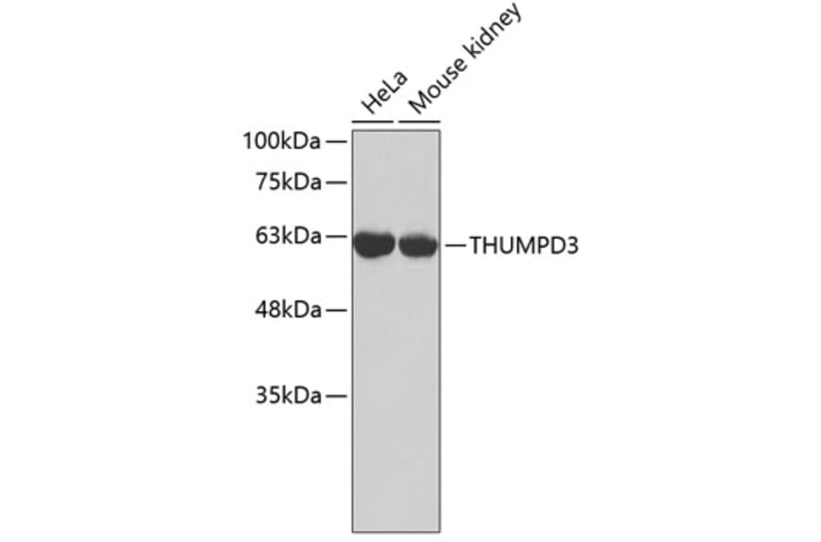 Western Blot - Anti-THUMPD3 Antibody (A3404) - Antibodies.com