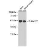 Western Blot - Anti-THUMPD3 Antibody (A3404) - Antibodies.com