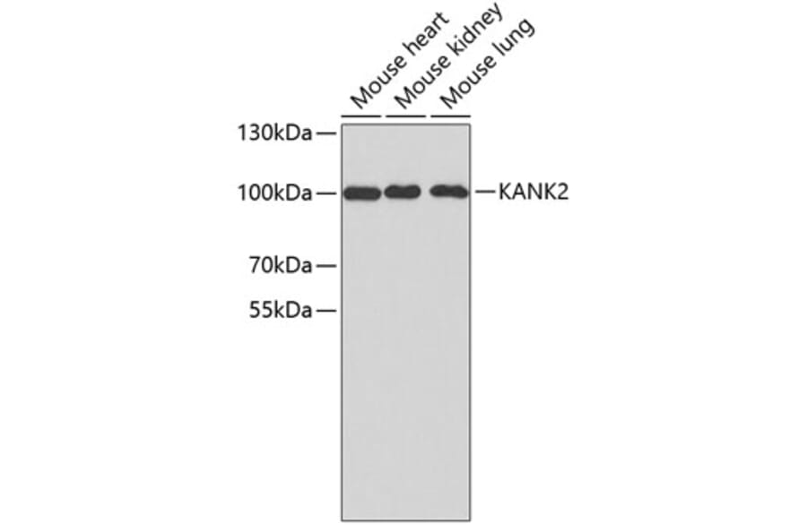 Western Blot - Anti-KANK2 Antibody (A3406) - Antibodies.com
