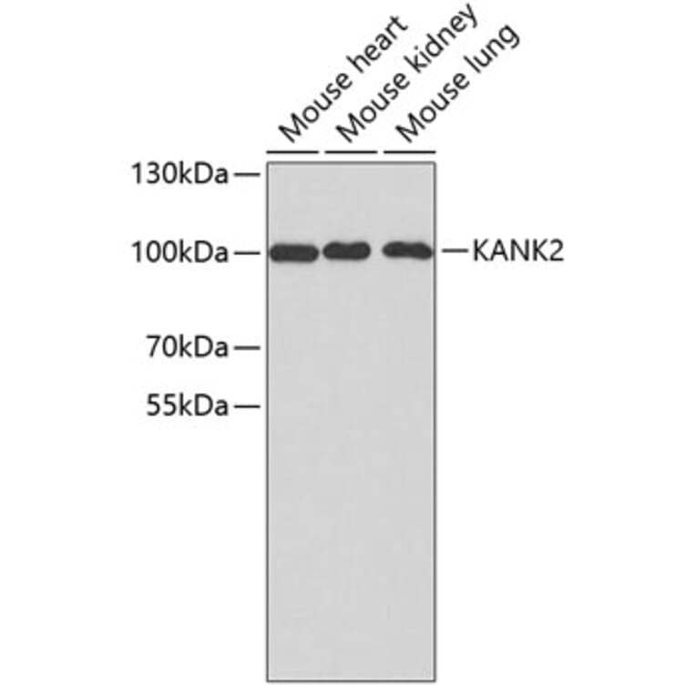 Western Blot - Anti-KANK2 Antibody (A3406) - Antibodies.com