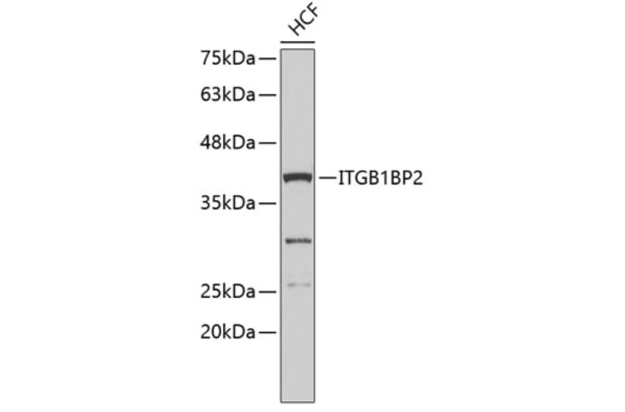 Western Blot - Anti-ITGB1BP2 Antibody (A3411) - Antibodies.com