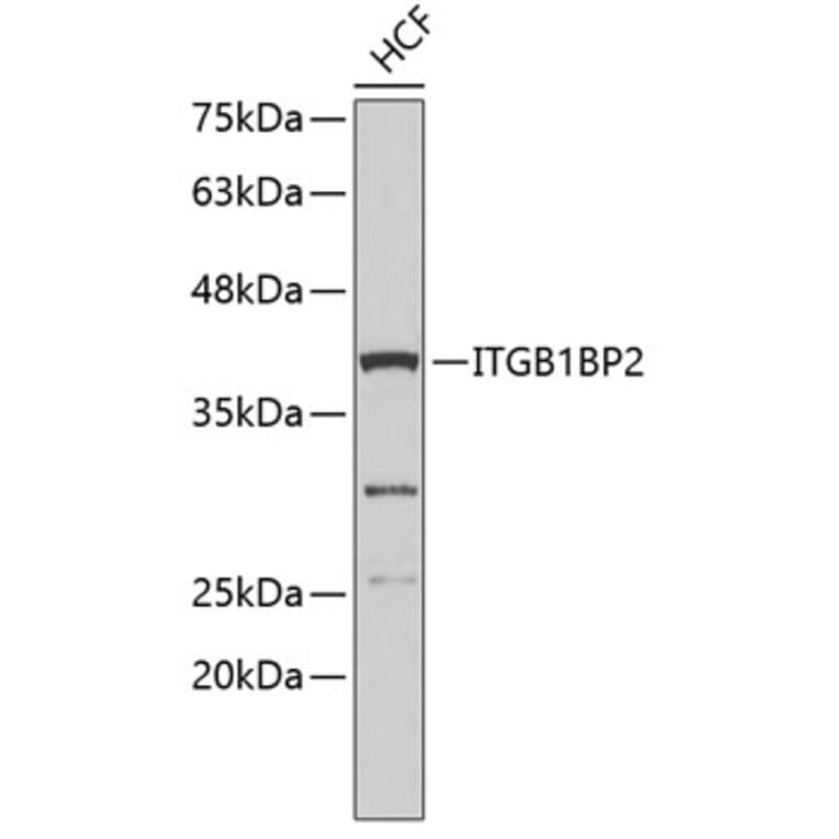 Western Blot - Anti-ITGB1BP2 Antibody (A3411) - Antibodies.com