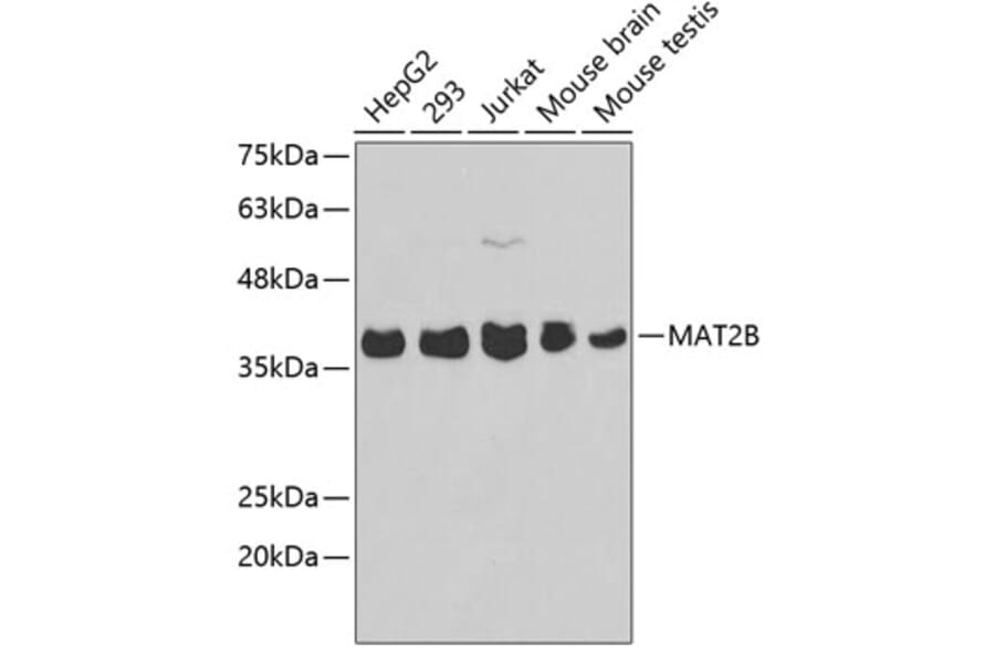 Western Blot - Anti-MAT2B Antibody (A3421) - Antibodies.com