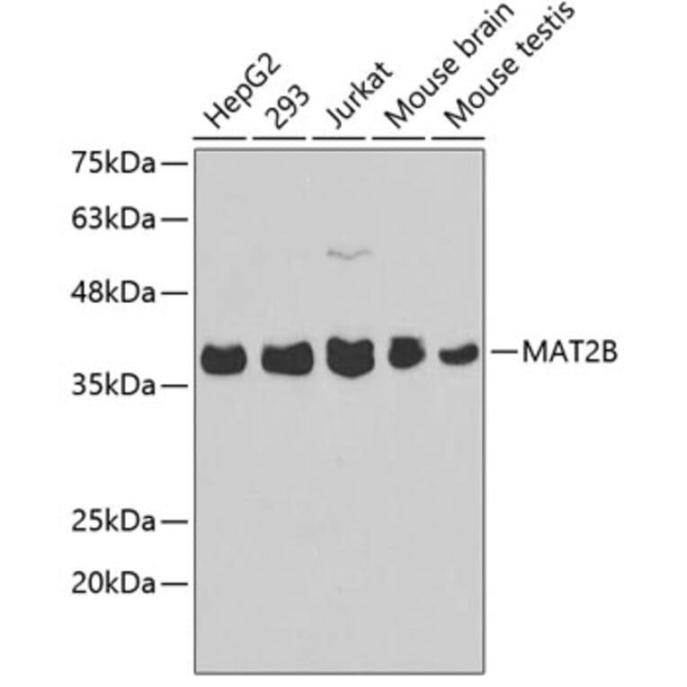 Western Blot - Anti-MAT2B Antibody (A3421) - Antibodies.com