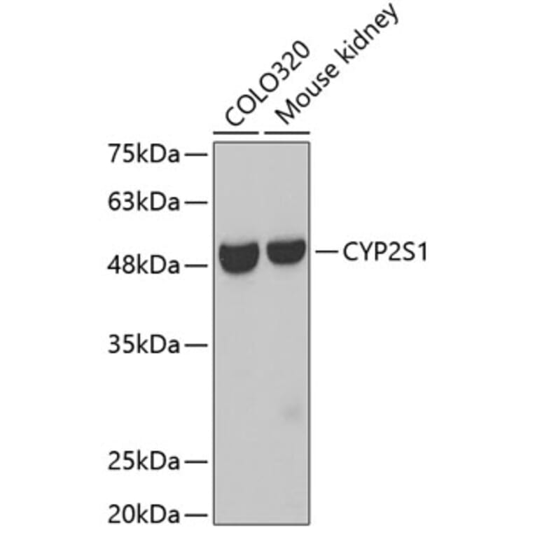 Western Blot - Anti-CYP2S1 Antibody (A3425) - Antibodies.com