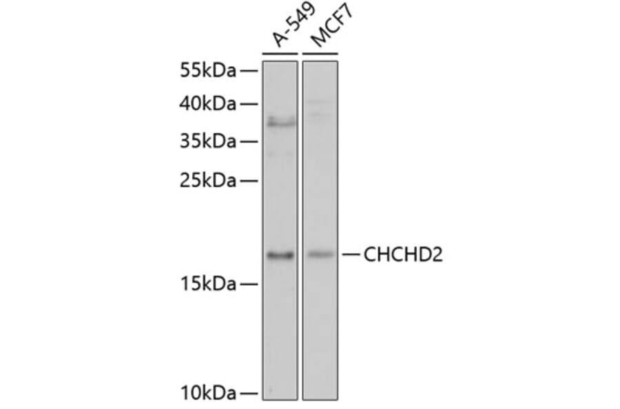 Western Blot - Anti-CHCHD2 Antibody (A3429) - Antibodies.com