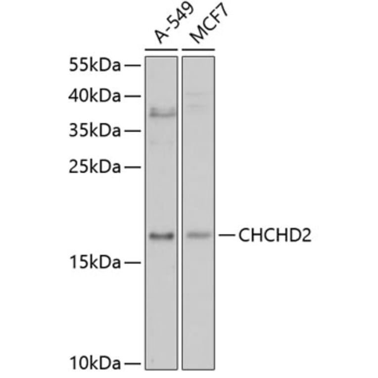 Western Blot - Anti-CHCHD2 Antibody (A3429) - Antibodies.com