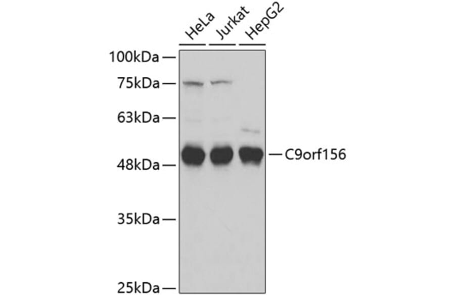 Western Blot - Anti-C9orf156 Antibody (A3434) - Antibodies.com