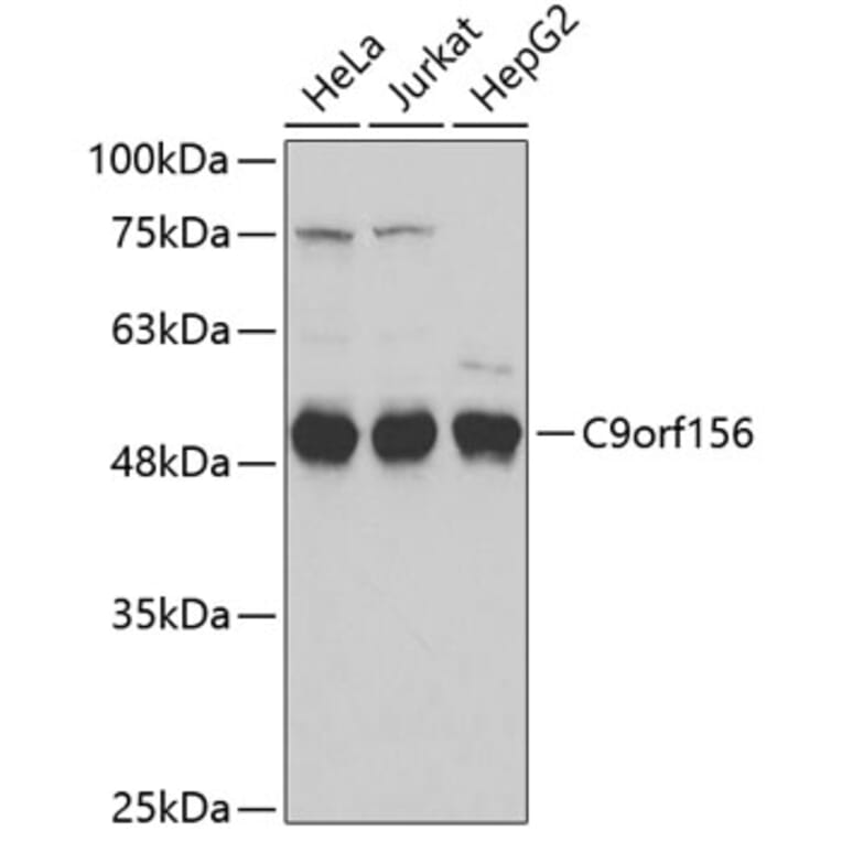 Western Blot - Anti-C9orf156 Antibody (A3434) - Antibodies.com