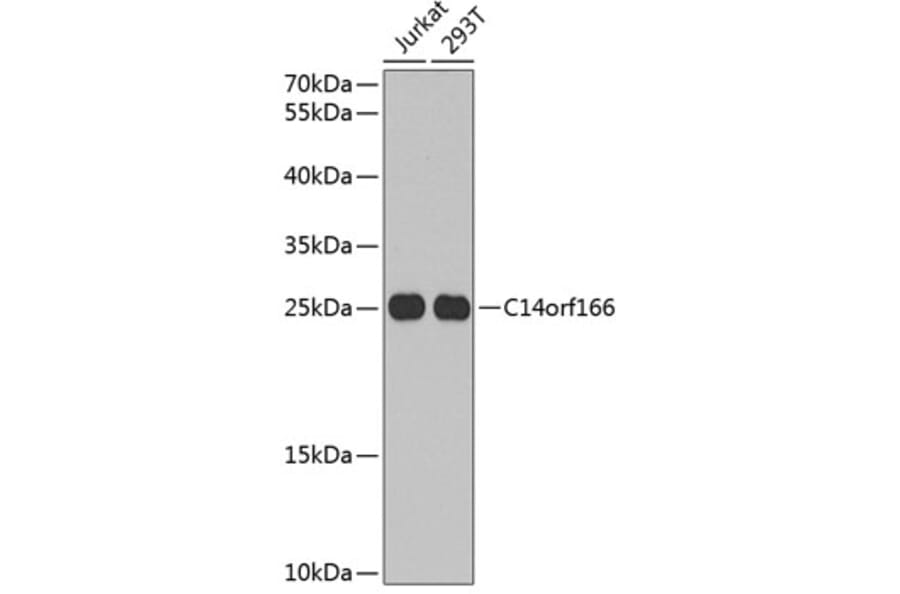 Western Blot - Anti-C14orf166 Antibody (A9211) - Antibodies.com