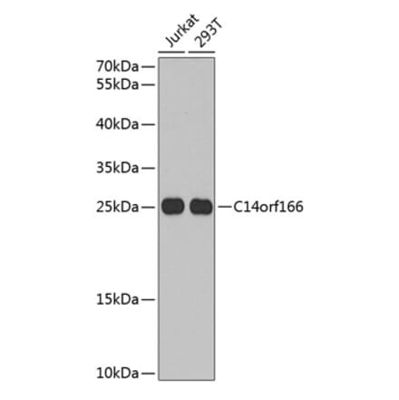 Western Blot - Anti-C14orf166 Antibody (A9211) - Antibodies.com