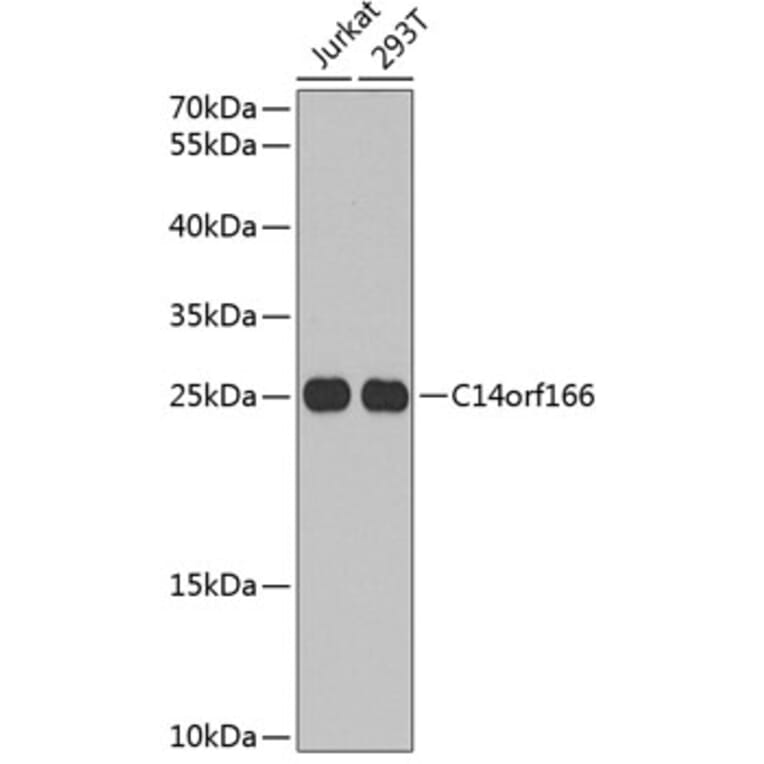 Western Blot - Anti-C14orf166 Antibody (A9211) - Antibodies.com
