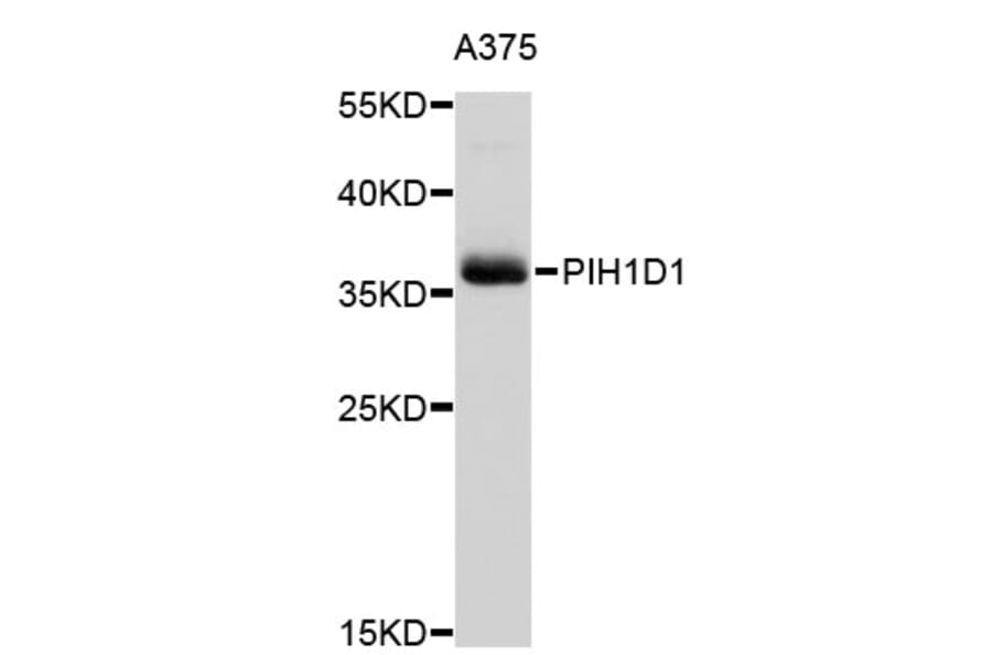 Western Blot - Anti-PIH1D1 Antibody (A3445) - Antibodies.com