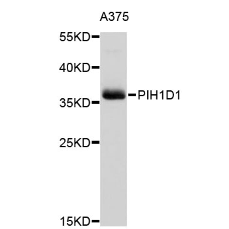 Western Blot - Anti-PIH1D1 Antibody (A3445) - Antibodies.com
