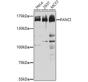 Western Blot - Anti-FANCI Antibody (A9213) - Antibodies.com