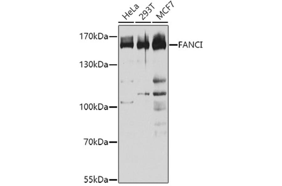 Western Blot - Anti-FANCI Antibody (A9213) - Antibodies.com