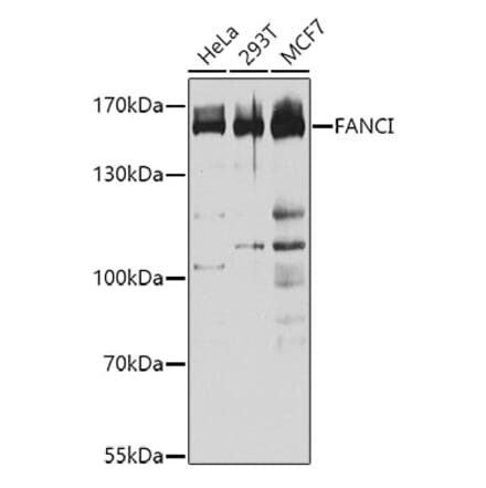 Western Blot - Anti-FANCI Antibody (A9213) - Antibodies.com