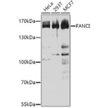 Western Blot - Anti-FANCI Antibody (A9213) - Antibodies.com