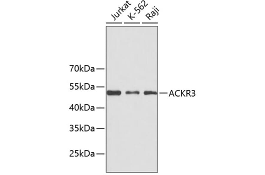 Western Blot - Anti-ACKR3 Antibody (A3468) - Antibodies.com