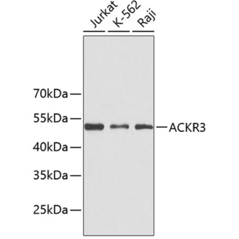 Western Blot - Anti-ACKR3 Antibody (A3468) - Antibodies.com